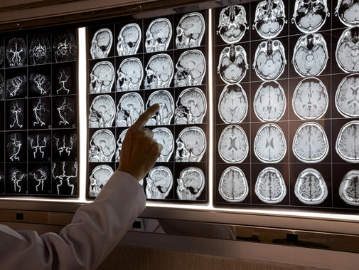 neurology 